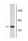 Anti-DOPA Decarboxylase Antibody